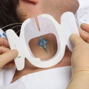 Повязка Tegaderm CHG 1657R пленочная прозрачная с хлоргексидином антимикробная для катетеров 8.5см х 11.5см фото 1110