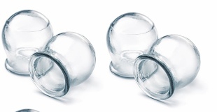 Банки стеклянные вакуумные медицинские 4 шт фото 1275